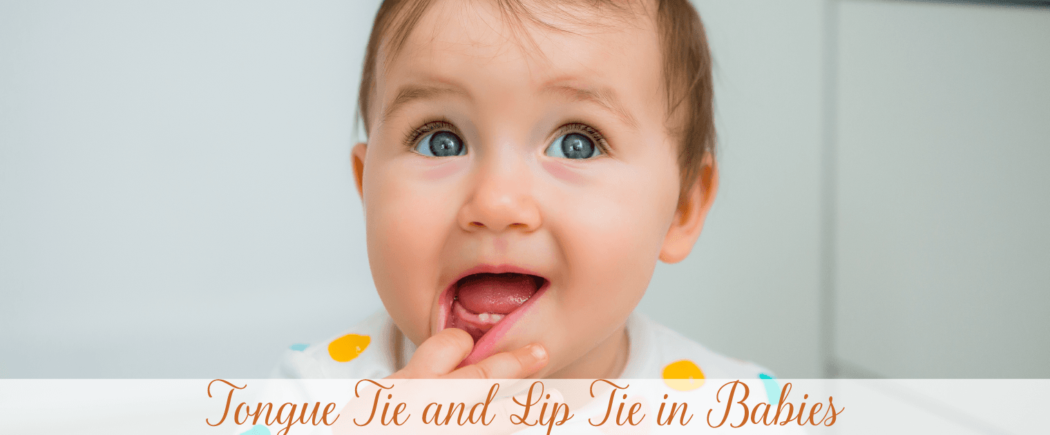 Top 5 Signs of Tongue Tie and Lip Tie in Babies