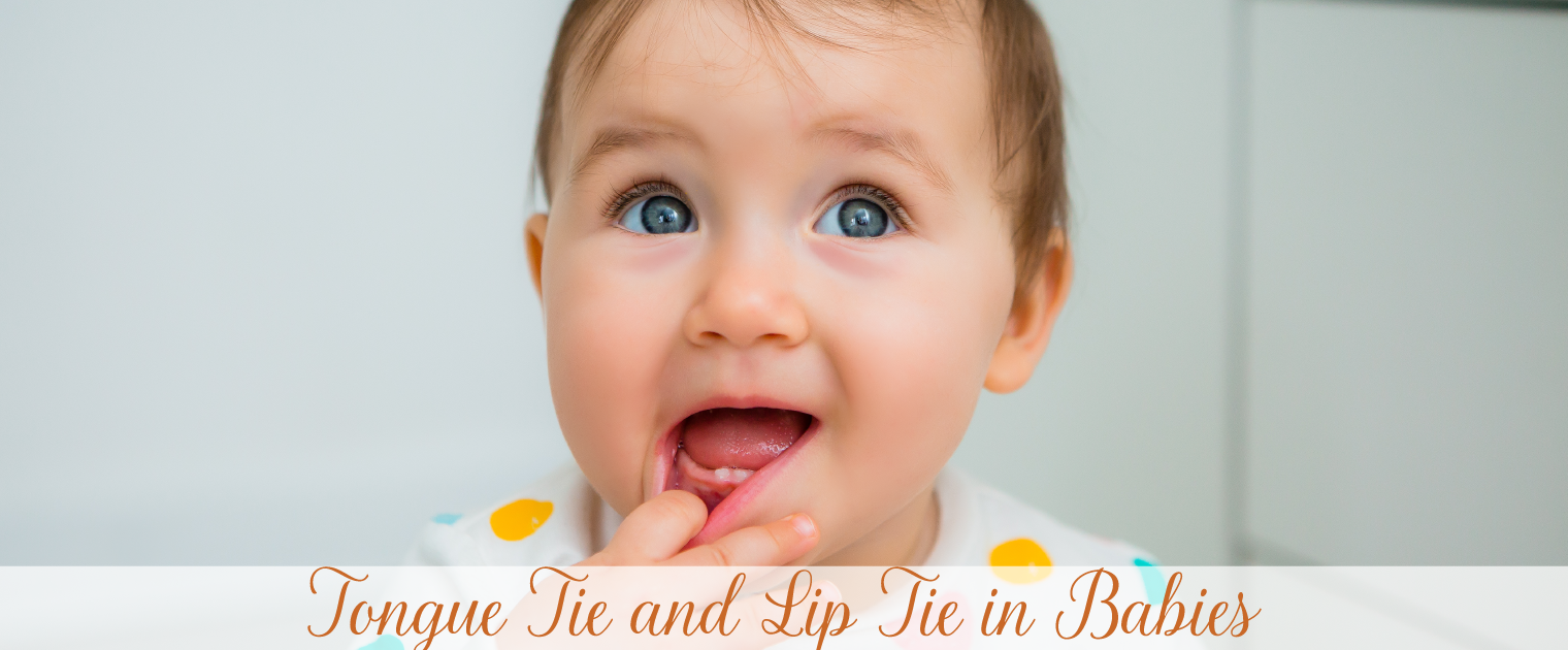 Tongue-Tie-and-Lip-Tie-in-Babies